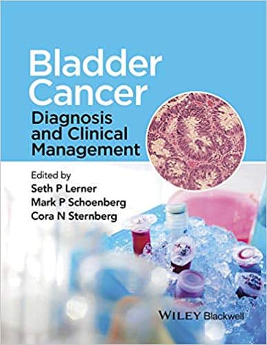 Bladder Cancer: Diagnosis and Clinical Management – eBook PDF 1 Bladder Cancer: Diagnosis and Clinical Management – eBook PDF
