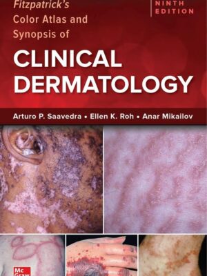 Fitzpatrick's Color Atlas and Synopsis of Clinical Dermatology (9th Edition) – eBook PDF